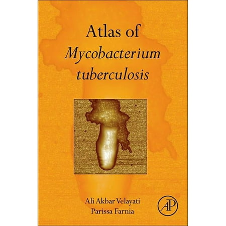 UPC: 9780128038086 | Atlas of Mycobacterium Tuberculosis (Hardcover)