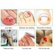 thumbnail image 4 of 10 Tiras Correctoras Para Uñas De Los Pies, Corrección Fuerte, Colocación De Pedidos Apalancados, Alivia Las Uñas Encarnadas, Promueve El Crecimiento Correcto De Las Uñas,, 4 of 7