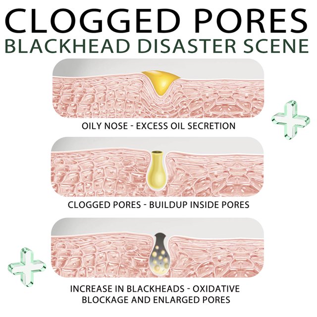 Mascarilla Para Quitar Puntos Negros Máscaras de eliminación de espinillas de suciedad de 15 g para hombres mujeres máscaras de peeling de té verde cuidado de la piel Sywqhk Cuidado Belleza