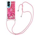 thumbnail image 1 of Funda FOXDOCK para Honor 90 Lite con Cuerda Ajustable, Brillo Líquido, Protección Antigolpes y Lente – Ideal para Regalo, 1 of 6