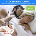 thumbnail image 5 of Effective Anti Snore, Chin Strap,Anti Snoring Chin Strap,Snore Solution Adjustab, 5 of 5