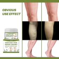 thumbnail image 2 of 3 unidades, nueva crema para reparación de patas de araña, crema para tratamiento de venas varicosas, crema para el cuidado de las piernas, hinchazón de patas Afortunado Sencillez, 2 of 2