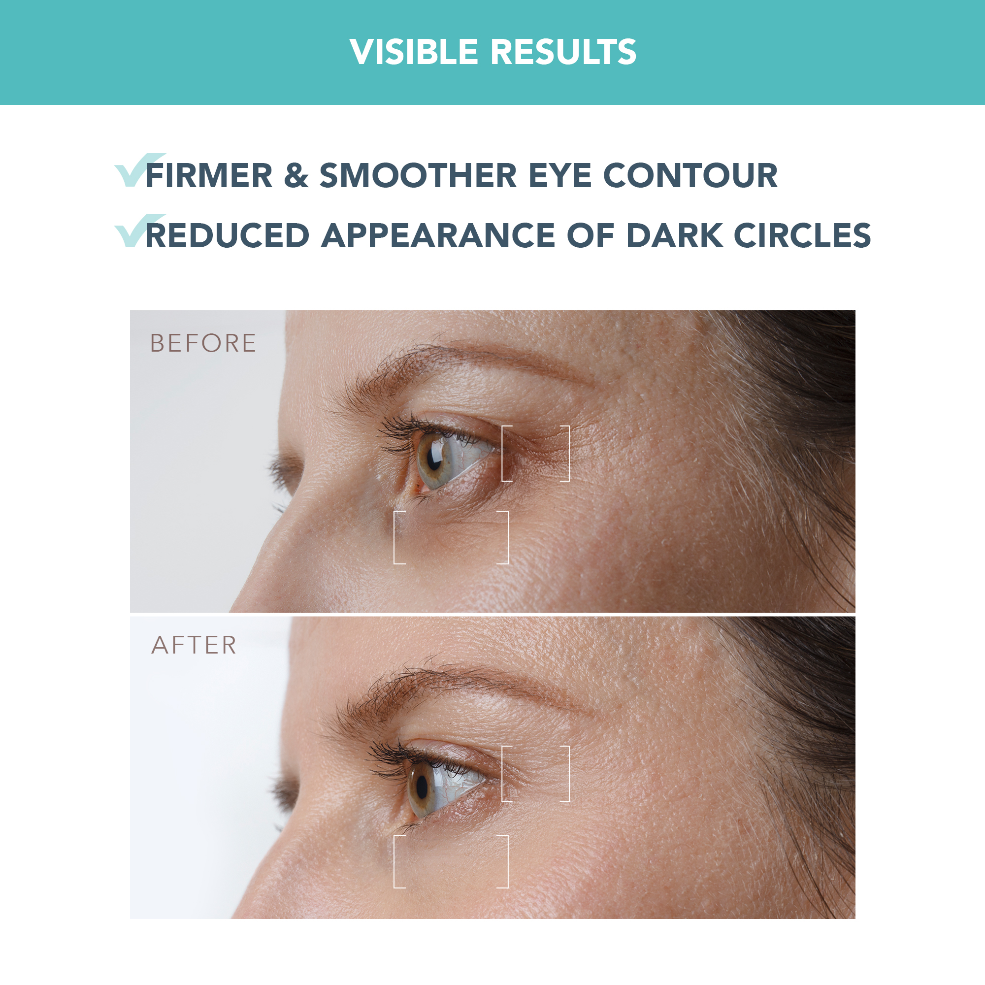 FOREO IRIS PM Eye Serum 0.5 fl.oz