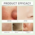 thumbnail image 2 of ONLYEOR 2pcs Facial Exfoliating Gel, Purifying Exfoliating Gel Moisturizing Cleanses Skin, Facial Scrub Exfoliator, Body Exfoliating Scrub Gel and Deep Cleansing Face, Cleansing Moisturizing, 2 of 7