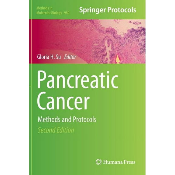 Methods in Molecular Biology Pancreatic Cancer: Methods and Protocols, Book 980, (Hardcover)