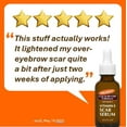 thumbnail image 3 of Palmer's, Cocoa Butter Formula Scar Serum With Vitamin E 1899280MA, 1 Ounce, 3 of 7