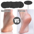 thumbnail image 2 of Vocoste Sandpaper Disk Replacement Pad Foot File Callus Remover Tool Coarse 80 Grit 35mm 100 Pcs, 2 of 7