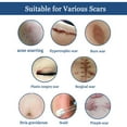 thumbnail image 2 of Scar Removal Cream Acne Scar Remover Cream Smooth Scar Lightening Cream, 2 of 9