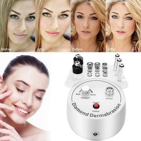 Yosoo 3 in 1 Diamond Microdermabrasion Dermabrasion Machine Facial Beauty Instrument for Home Use(US),  Microdermabrasion Machine, Facial (Best Professional Diamond Microdermabrasion Machine Reviews)