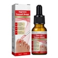 thumbnail image 1 of Gotas Para Uñas Encarnadas Suero Reparador De Uñas 10 Ml ANGGREK, 1 of 8