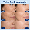 thumbnail image 2 of SAISZE Vitamin C Serum, Retinol Serum & Hyaluronic Acid Serum Set, Anti-Aging Face Serum Set for Face, Day & Night Skincare Routine, Firming & Hydrating, 2 fl oz x 3, 2 of 8