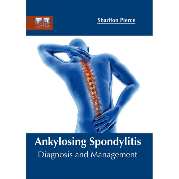 Ankylosing Spondylitis: Diagnosis and Management, (Hardcover)