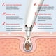 thumbnail image 5 of Aspirador de puntos negros, extractor de poros, compresa caliente, 3 niveles de succión, pantalla LED, recargable, kit de belleza, 5 of 9