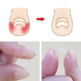 thumbnail image 4 of 100 tiras correctoras para uñas encarnadas y herramientas para el cuidado de las uñas (transparentes), 4 of 7
