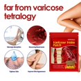 thumbnail image 3 of Vein Healing Massage Plaster Effective Feet Treatment Elder Applicable Plaster for Poor Blood Flow in the Lower Limbs, 3 of 5