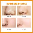 thumbnail image 3 of Removedor De Espinillas De Nariz Mascarilla para eliminar puntos negros de la nariz, limpieza profunda de la piel, tira retráctil para poros (blanco) Ygjytge Cuidado Belleza, 3 of 4