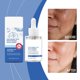 thumbnail image 2 of Hidratante facial hialurónico repara la barrera cutánea, hidratante y revitalizante facial, 30 ml, líquidos esenciales, 2 of 5