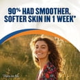 thumbnail image 5 of Gold Bond Ultimate Rough And Bumpy Skin Cream - 8 Oz, 3 Pack, 5 of 6