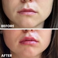 thumbnail image 6 of Transformulas Facefixers Lipvolume Original Lip Plumping Serum Peptide Collagen Boosting Lip Gloss for Instant Volume & Hydration Healthy 3D Effect No Sting Formula, Cruelty Free 3ml, 6 of 7