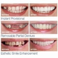 thumbnail image 2 of Juego Smile Snap On LIUYMXG Dentadura postiza Carillas dentales Cubierta dental para dientes NGC, 2 of 5