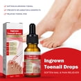 thumbnail image 5 of Dispositivo de tratamiento láser para hongos en las uñas, onicomicosis, reparación de uñas, esencia, antiinfección, paroniquia, uña encarnada, dispositivo para el cuidado de los pies, 5 of 5