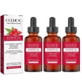 thumbnail image 1 of 3X Rosehip Oil, 100% Pure & Natural Cold Pressed Pure Rose Hip Best Facial Oil 30ml, 1 of 4