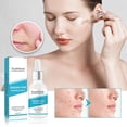 thumbnail image 3 of Salicylic Acid Exfoliating Essence, Deep Clean Skin Pores Exfoliate And Moisturize Essence, 3 of 5