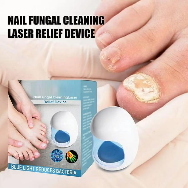Dispositivo de tratamiento láser para hongos en las uñas, dispositivo láser de limpieza de hongos en las uñas para uñas de los pies, terapia de onicomicosis, removedor de hongos en las uñas
