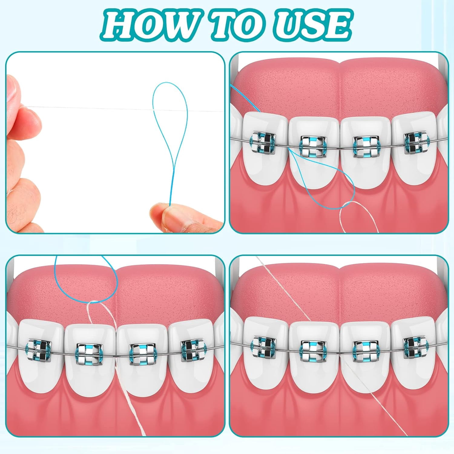 1000 Pcs Dental Floss Threaders Deep Clean Floss for Braces, Bridges, and Implants, Multifunctional Nylon Loop Design for Your Teeth, Pack of 20(Blue)