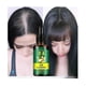 thumbnail image 3 of Aceite germinal de jengibre, aceite para el crecimiento del cabello, suero para el crecimiento del cabello, tratamiento para la pérdida de cabello, cuidado del cabello, suero para el crecimiento del cabello, promueve el crecimiento del cabello más grueso-2PCS- Sincero Electrónica, 3 of 5