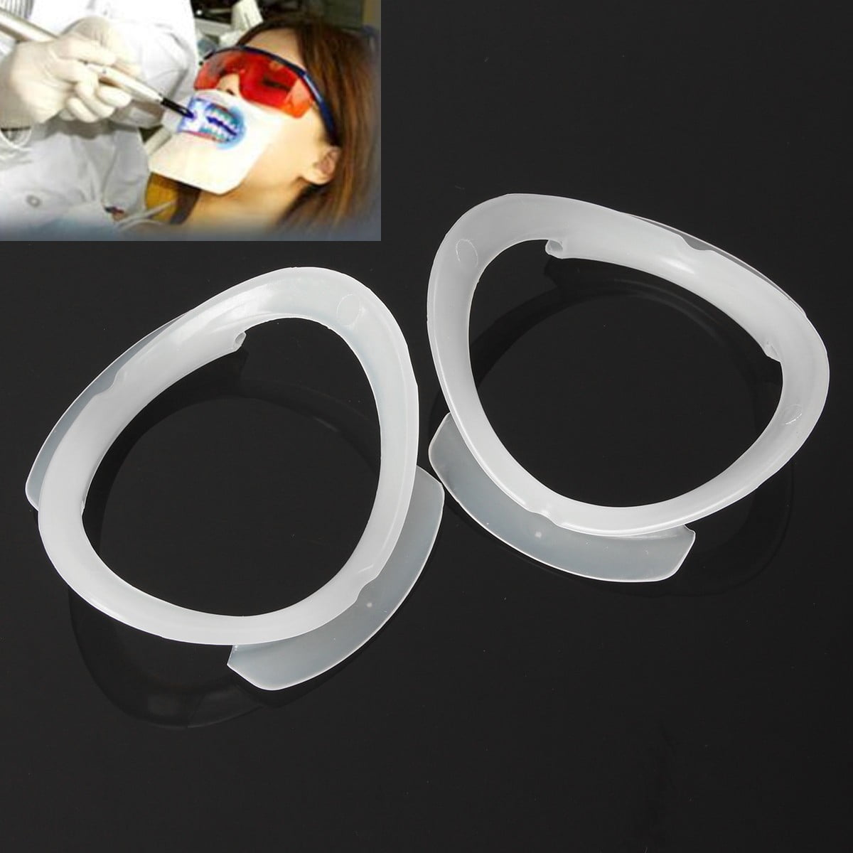 Dental Mouth Openers - Reliable Cheek Retractors For Dentistry - View #11