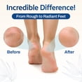thumbnail image 5 of HartFelt Magic Stone Feet Scrubbing Pedicure Stone for Women and Men, Exfoliating Heels, Pack of 1, 5 of 9