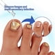 thumbnail image 3 of Nail Repair Essences Multipurpose Onychomycosis Care Solution Nail Care Supplies, 3 of 5