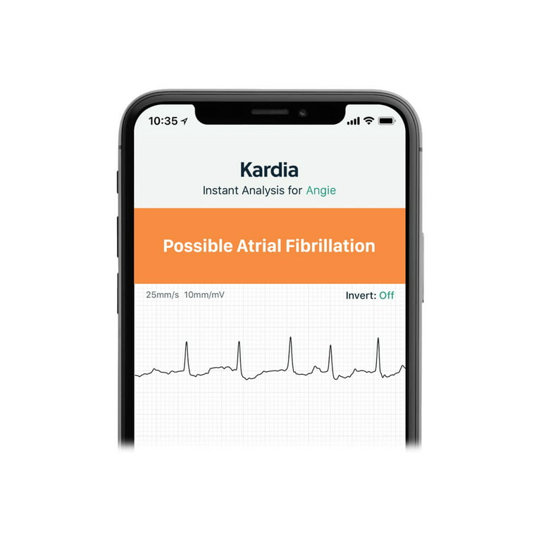 AliveCor Kardia Mobile 6L FDA Cleared- Mobile ECG Device, New 