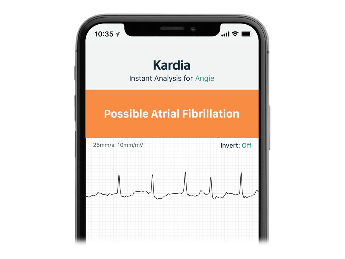 AliveCor Kardia Mobile 6L FDA Cleared- Mobile ECG device