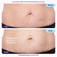 thumbnail image 3 of Crema Reafirmante para Abdomen goPure 125 mL, 3 of 8