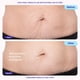 thumbnail image 3 of Crema Reafirmante para Abdomen goPure 125 mL, 3 of 8