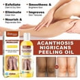 thumbnail image 2 of Acanthosis Nigricans Peeling Oil 110ml, 2 of 3