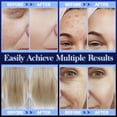 thumbnail image 4 of Varita facial de alta frecuencia - Uaike Máquina facial portátil de mano azul de alta frecuencia para la piel en casa - Dispositivo de varita facial para la piel con 4 tubos de vidrio azules diferente, 4 of 5