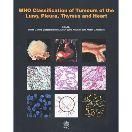 Who Classification of Tumours of the Lung, Pleura, Thymus and Heart