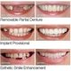 thumbnail image 3 of Sonrisa a presión en dientes postizos superior inferior carillas dentales dentaduras conjunto de cubierta de dientes, 3 of 5