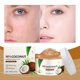 thumbnail image 3 of Crema hidratante, crema hidratante de coco, gel hidratante y hidratante, esencia facial hidratante, reparadora y alivia la picazón después de las quemaduras solares, gel hidratante facial de 100 g., 3 of 5
