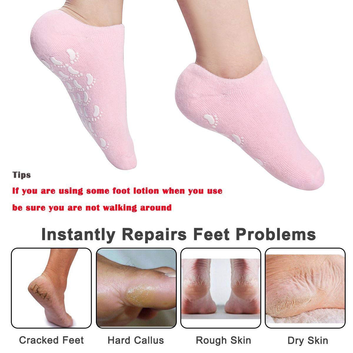 What Causes Cracked Heels? 3 Potential Causes + Treatment
