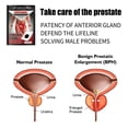 thumbnail image 4 of 10 Uds parche de próstata masculino prostatitis pegatina tratamiento hombres cuidado de la salud Likrtyny cuidado belleza, 4 of 5