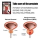 thumbnail image 4 of 10 Uds parche de próstata masculino prostatitis pegatina tratamiento hombres cuidado de la salud Tmvgtek cuidado belleza, 4 of 5