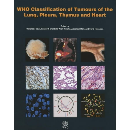 Who Classification of Tumours of the Lung, Pleura, Thymus and Heart
