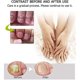 thumbnail image 4 of 1/2/3pcs Nail Repair - Nail Treatment Repair Gelnail & Toenail Treatment Nail Repair Cream Health Instant Beauty Cream Renews Yellow & Cracked, 4 of 4