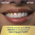thumbnail image 6 of Waterpik Evolution Water Flosser with 10 Settings, 5 Tips, ADA Accepted, White, 6 of 14