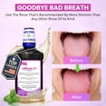 thumbnail image 3 of ioRinse RTU Halitosis Mouthwash for Fresh Breath, Dentists' Top Choice, Alcohol Free & Fluoride Free Molecular Iodine Oral Rinse, Soft Mint, Professional Clean Mouth Wash, RTU Mouthwash 33.8 oz, 3 of 9