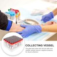 thumbnail image 3 of 100 Pcs Vacuum Tube Blood Collector Tubes Blood Collecting Tubes Tubes Lid Test Tubes Cover, 3 of 4